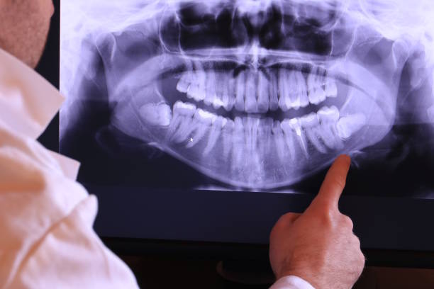 Best Dentist for Tooth Abscess  in Bouse, AZ