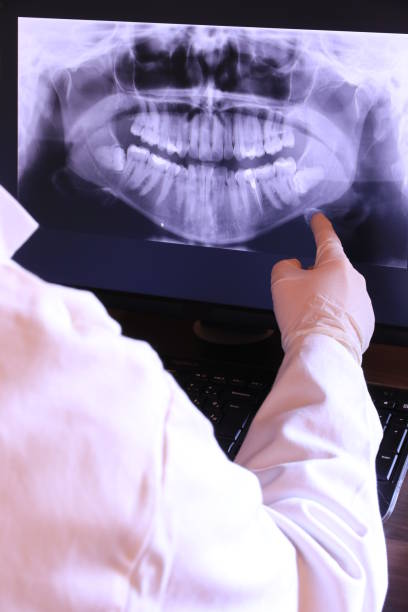 Emergency Dental Filling Replacement in AZ