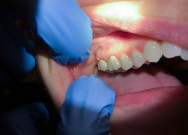 Best Cracked Tooth Emergency Dentist  in Bouse, AZ